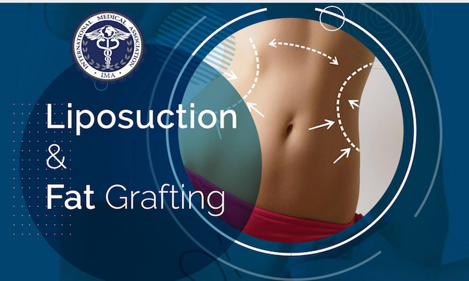 Liposuction and Fat Grafting
